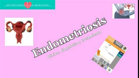 endometriosis gpc 2024